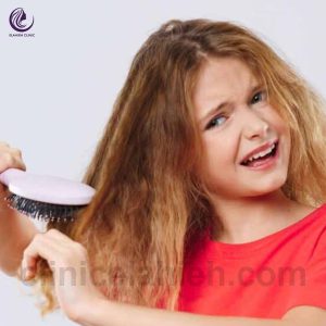 بیماریهای مو در کودکان